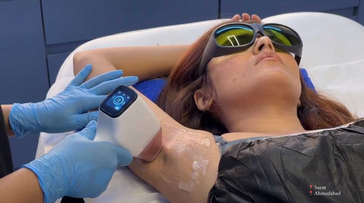 Best laser hair removal clinics in Surat 2026