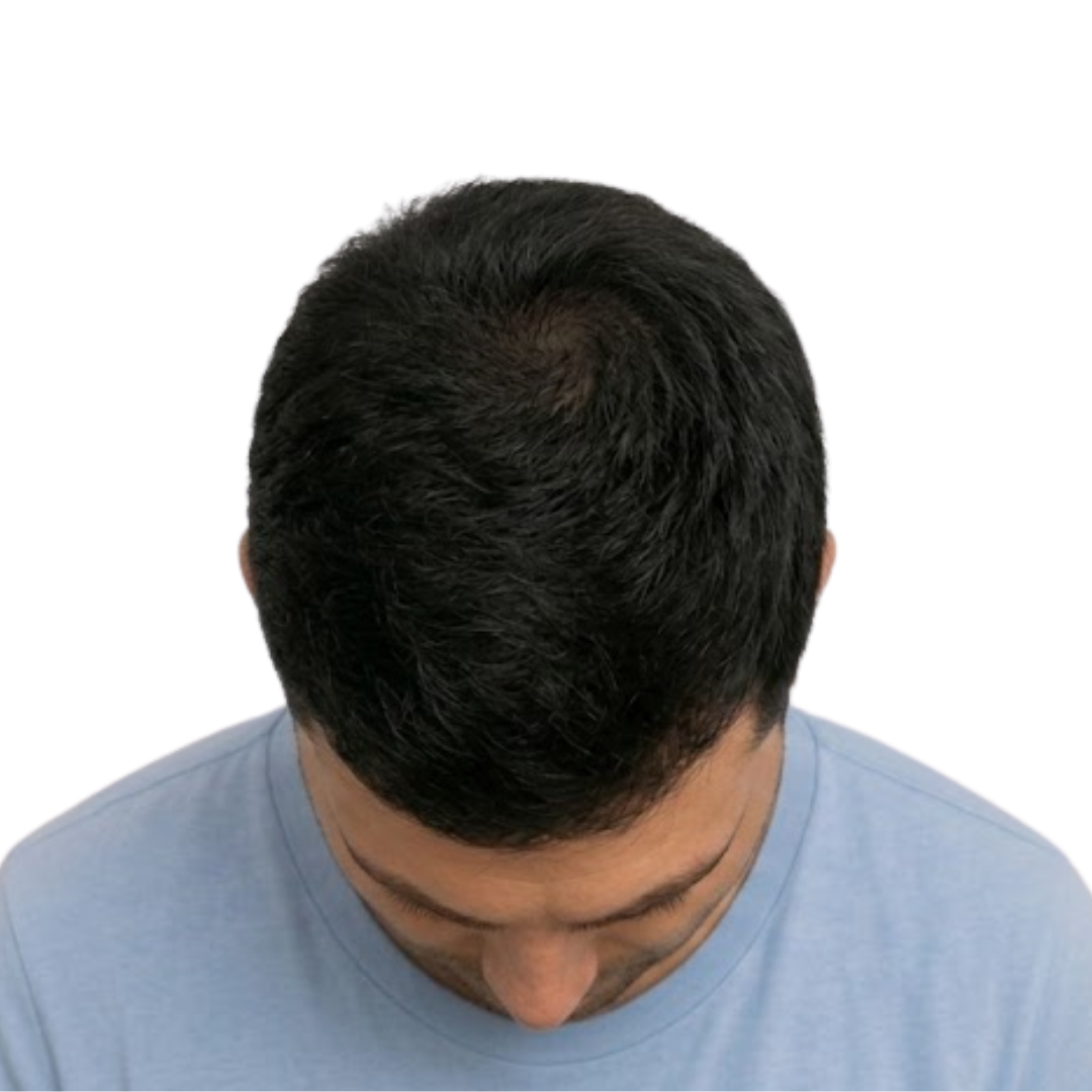 After